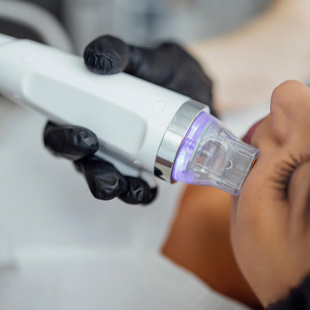 Exosomea Treatment