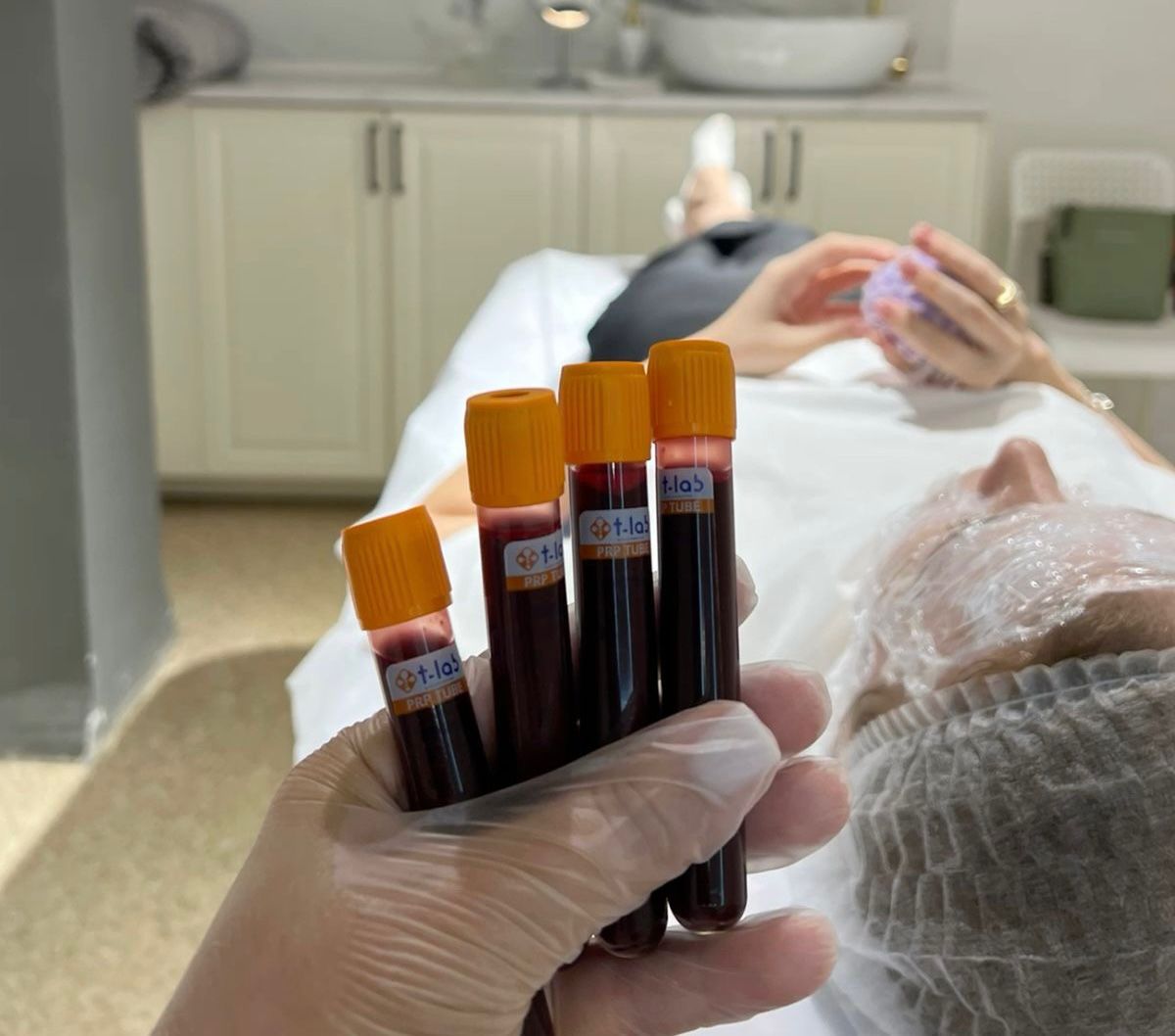 PRP Repair Treatment